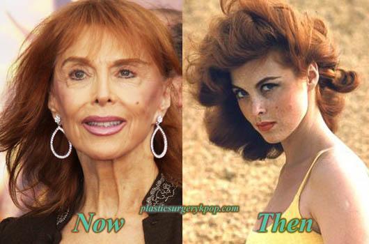 Tina-Louise-Plastic-Surgery.thumb.jpg.fb
