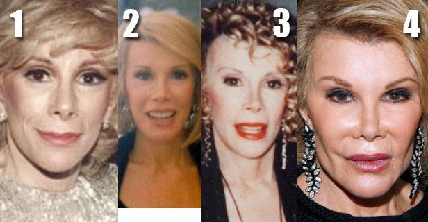 joan_rivers_plastic_surgery_face.thumb.j
